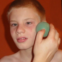 Loptikovanie (loptikov facilitcia)